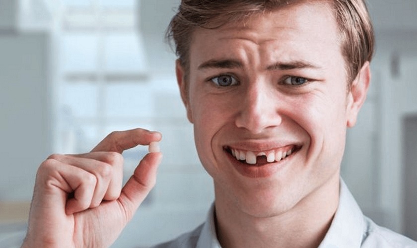 Giải mã giấc mộng răng cửa rụng