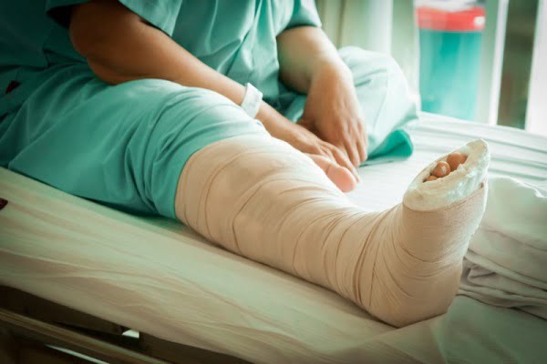 Mơ thấy bạn bè hoặc đồng nghiệp bị gãy chân
