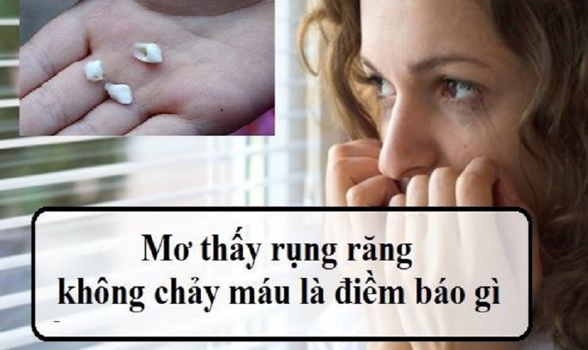 Nằm Mơ Thấy Mình Bị Rụng Răng