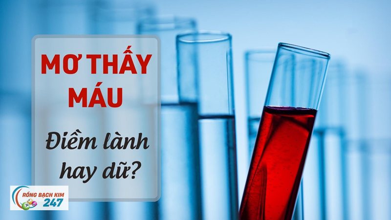 Mơ thấy chảy máu - Người xưa nhìn hình ảnh máu chảy ra sao